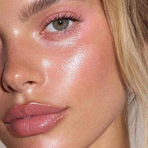 JUVÉDERM® Ultra XC