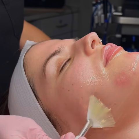 SkinMedica Illuminize Peel