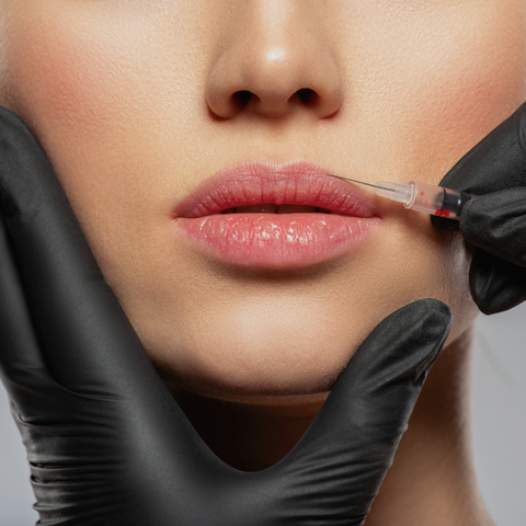 Restylane® KYSSE™